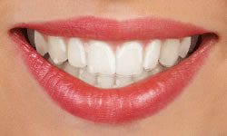 clear aligners or Invisalign at cherry orthodontics