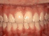 Common Orthodontic Issues