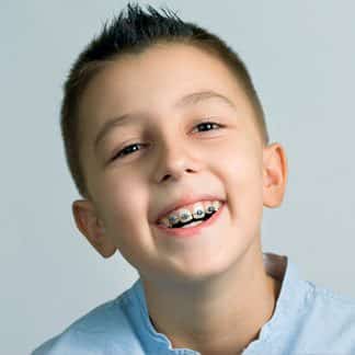 two-phase orthodontic treatment