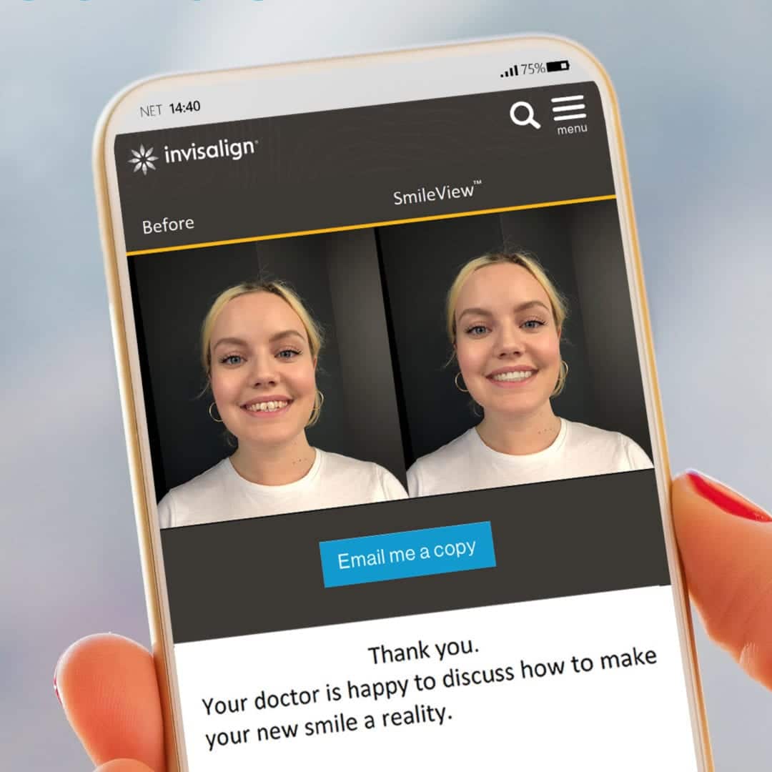 invisalign smileview