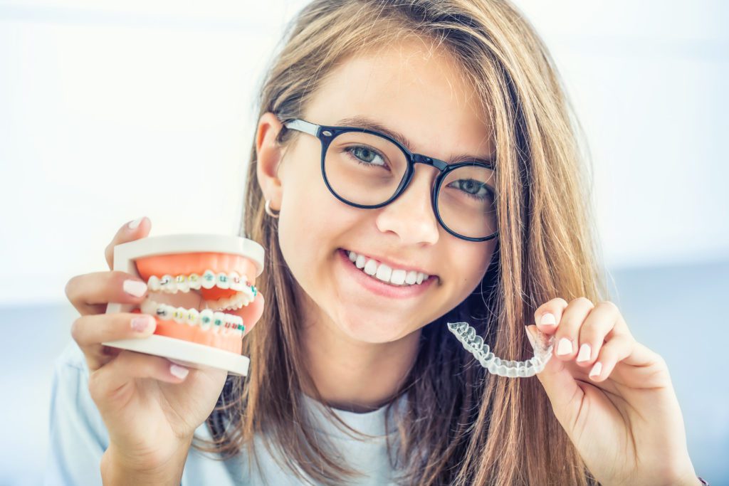 impacted canines invisalign