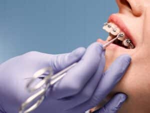 Orthodontic Treatments Bethlehem