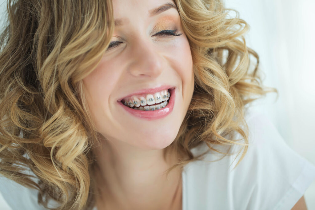 Metal Braces in Bethlehem